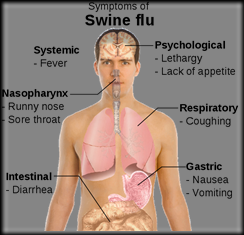 622px-Symptoms_of_swine_flu.svg