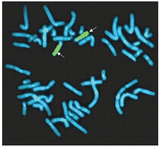 A metaphase cell showing two chromosome 15s with whole-chromosome paint probes (arrow, green signal) of chromosome 15 