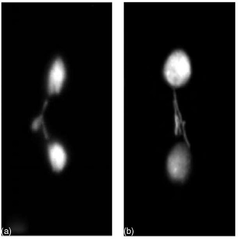 X-chromosome elimination from the soma in S. ocellaris embryos. DAPI-stained early syncitial somatic divisions. Lagging X chromosomes in somatic division undergoing elimination. Only one X chromosome is discarded from cells of female embryos (a), while two X chromosomes are discarded from cells of male embryos (b) 