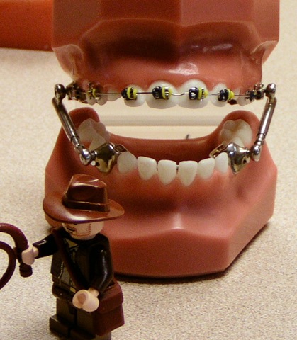 [Escape of Indiana Jones The second consult[4].jpg]