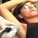 LaserHairRemoval-1