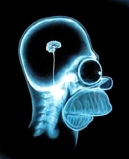 [Pea brain[7].jpg]
