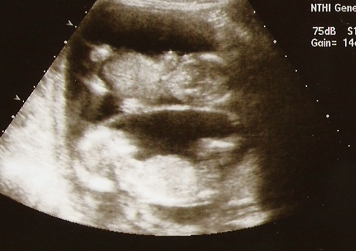 babies 14 weeks