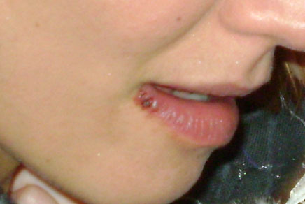 Y la celebridad con "eso" en el labio es...?