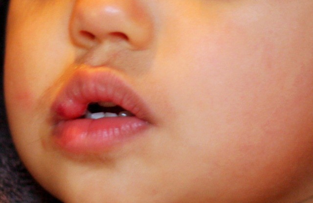 [PuffyLipper[5].jpg]