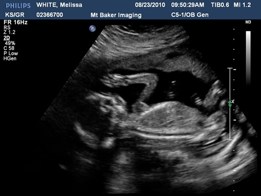 [WHITEMelissa20100823095029995[2].jpg]