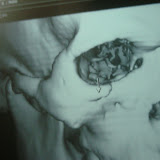 Cranium Pictures