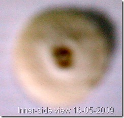 2009-05-16 - toeCornPeelOff (innerSide)