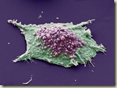 Lung-cancer-cell