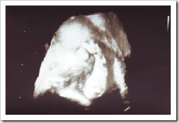 31 Week Ultrasound