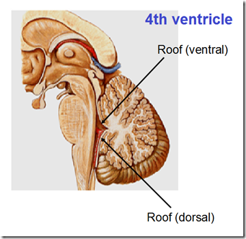 Management Of Tumors Of The Fourth Ventricle Neupsy Key