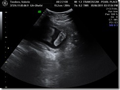 BABY_4 BABY_4