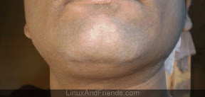 My face after the shave