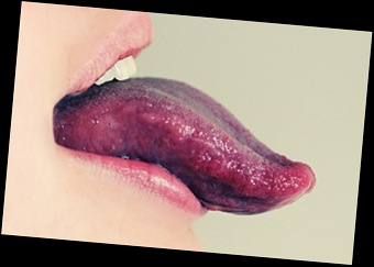 Tongue