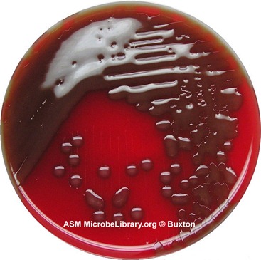 Streptococcus pneumoniae fig11