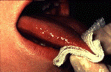 [TongueRightMargin[19].gif]