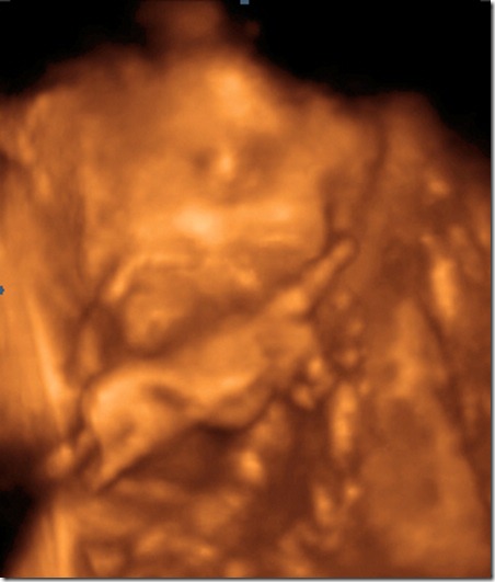 UC BABY2_25