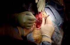 [surgery[4].jpg]
