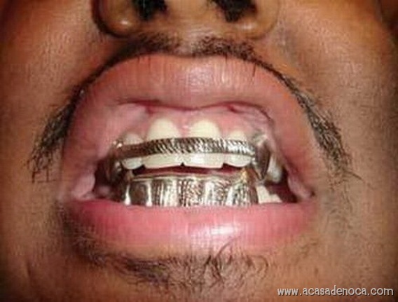 [thumbs_Grillz_030[8].jpg]