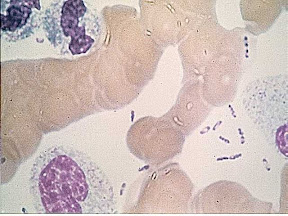 blood plaque