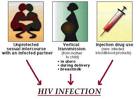 HIV infection