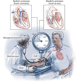 Hypertension