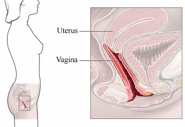 Bacterial vaginosis