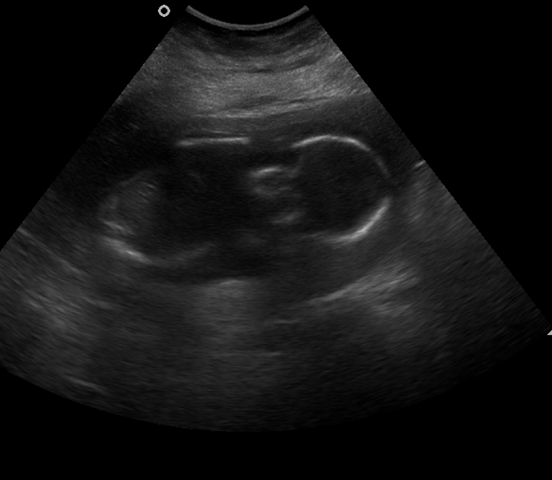 [426258_HORSFALL_20090908_075005_0023[1].png]