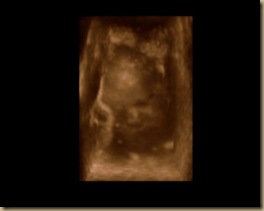 baby nephew