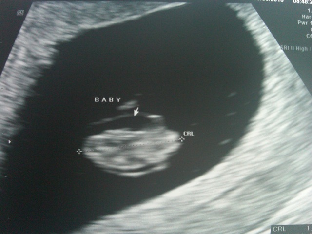 [IMG004892010093008533.jpg]