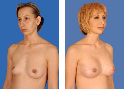 [breast_enlarge[2].jpg]