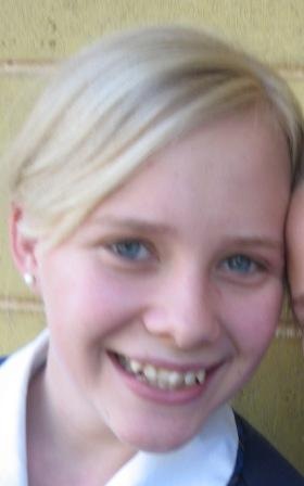 [pre braces[3].jpg]