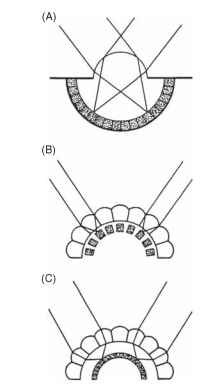 The three types of eye found in insects. (A) Simple, or single-chambered, (B) apposition compound, (C) superposition compound. The receptors are shown stippled. 