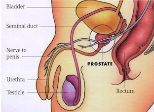 [prostrate[3].jpg]