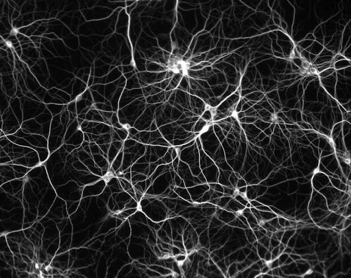 Dissociated culture of hippocampal neurons. © Copyright 2004, Paul De Koninck. All rights reserved. Dissociated culture of hippocampal neurons. © Copyright 2004, Paul De Koninck. All rights reserved. This image used to be called neuron_culture_800px.jpg