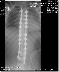 Logans x-rays after surgery