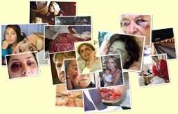 Kill the Boer Kill the Farmer victims trauma album weergegeven