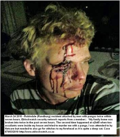 [Robindale youth attacked by panga March 242010 Eblockwatch[8].jpg]