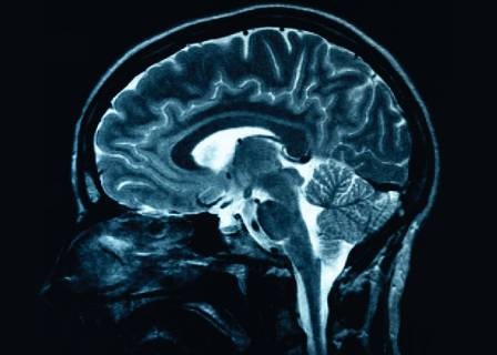[BrainScan university Erasmusmagazine nl[4].jpg]