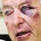 [Oudtshoorn van Donna after attack by 3 bikers Sterkfontein caves March 14 2009[8].jpg]