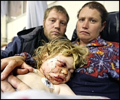 Merwe vd Rene mauled by Boerboel_dadNikkiStabbedDogToDeathAug1020009BeeldPic Merwe vd Rene mauled by Boerboel_dadNikkiStabbedDogToDeathAug1020009BeeldPic