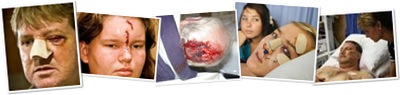Afrikaner Crime Victims TRAUMA PIXTURES weergegeven