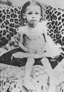 [Starving Boer Child Baden Power Concentration Camp[6].jpg]