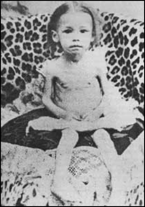 Starving Boer Child Baden Power Concentration Camp