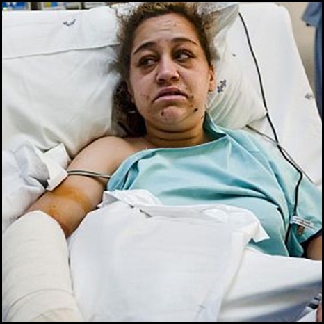 Vosloo Ciandi Centurion Academy arm nearly cut off by cellphone robbers UnitasHospitalBeeldOct212009