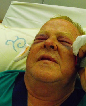 [Pretorius Marius top SA eye surgeon attackers tried to gouge out his eyes Vereeniging 20091206[6].jpg]