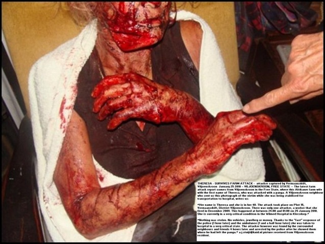[Eksteen Theresa panga attack victim Vermaansdrift Viljoenskroon AH Jan 25 2010[4].jpg]
