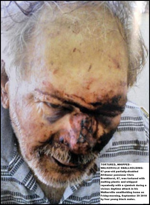 Bronkhorst Chris disabled Walkerville man tortured melt plastic and sjambok Sept292010 4 blacks Bronkhorst Chris disabled Walkerville man tortured melt plastic and sjambok Sept292010 4 blacks