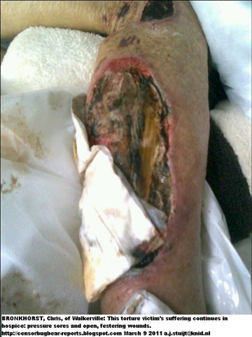 [Bronkhorst Chris attack victim maltreatment in hospice[4].jpg]