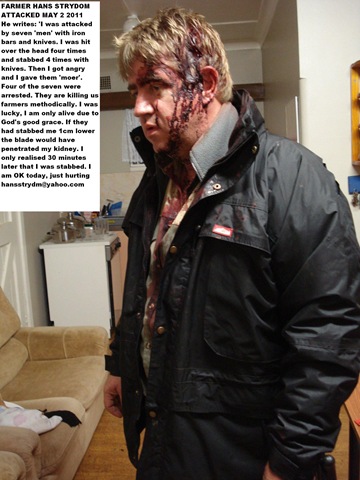 [Strydom Hans attacked farm May32011 10am hit with pipes by 7 black men[8].jpg]